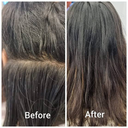 Heads Up No Lice™ ProVac Lice Removal Comb